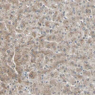 Immunohistochemistry-Paraffin: LHPP Antibody [NBP1-83272]
