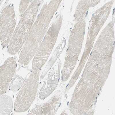 Immunohistochemistry-Paraffin: LHPP Antibody [NBP1-83272]