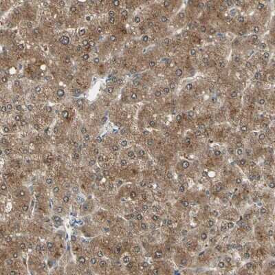 Immunohistochemistry-Paraffin: LHPP Antibody [NBP1-83273]