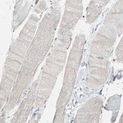 Immunohistochemistry-Paraffin: LHPP Antibody [NBP1-83273]