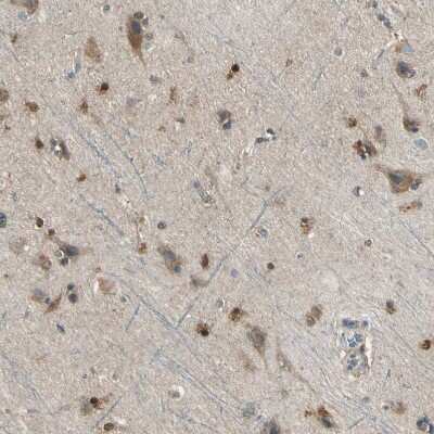 Immunohistochemistry-Paraffin: LHPP Antibody [NBP1-83273]