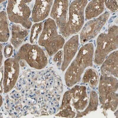 Immunohistochemistry-Paraffin: LHPP Antibody [NBP1-83273]