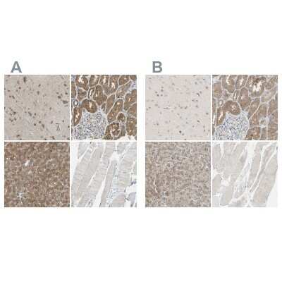 Immunohistochemistry-Paraffin: LHPP Antibody [NBP1-83273]