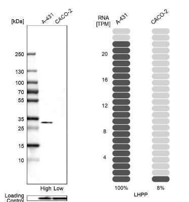 Western Blot: LHPP Antibody [NBP1-83273]