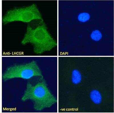 Immunofluorescence: LHR Antibody [NBP2-76804]