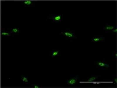 Immunocytochemistry/ Immunofluorescence: LHX2 Antibody (1E6) [H00009355-M02]