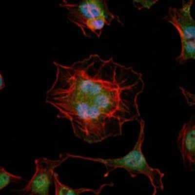 Immunocytochemistry/ Immunofluorescence: LHX2 Antibody (6G2) - BSA Free [NBP2-37619]