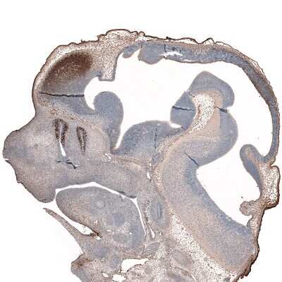 Immunohistochemistry-Paraffin: LHX2 Antibody (CL6137) [NBP2-61435]