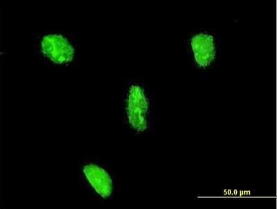 Immunocytochemistry/ Immunofluorescence: LHX3 Antibody (2C10) [H00008022-M08]