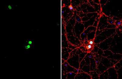 Immunocytochemistry/ Immunofluorescence: LHX3 Antibody [NBP3-13352]