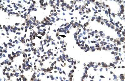 Immunohistochemistry: LHX3 Antibody [NBP2-84135]