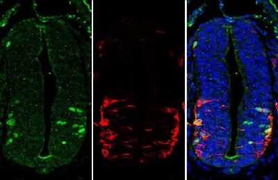 Immunohistochemistry-Paraffin: LHX3 Antibody [NBP3-13352]