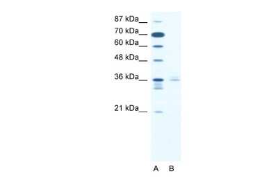Western Blot: LHX3 Antibody [NBP2-84133]