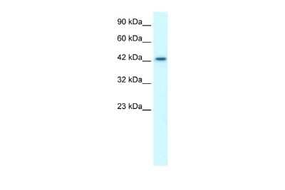 Western Blot: LHX3 Antibody [NBP2-84135]
