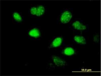 Immunocytochemistry/ Immunofluorescence: LHX5 Antibody (2B11) [H00064211-M05]