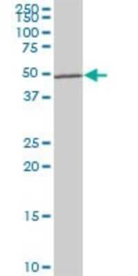 Western Blot: LHX5 Antibody (2B11) [H00064211-M05]