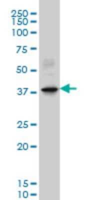 Western Blot: LHX6 Antibody (3D9) [H00026468-M01]