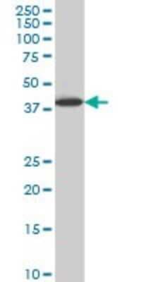 Western Blot: LHX6 Antibody (3E8) [H00026468-M05]