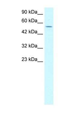 Western Blot: LHX6 Antibody [NB200-526]