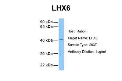 Western Blot: LHX6 Antibody [NB200-526]