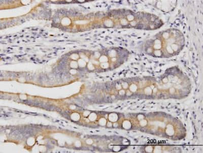 Immunohistochemistry-Paraffin: LIAS Antibody (1C7) [H00011019-M03]