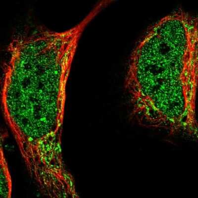 Immunocytochemistry/ Immunofluorescence: LIAS Antibody [NBP1-82845]