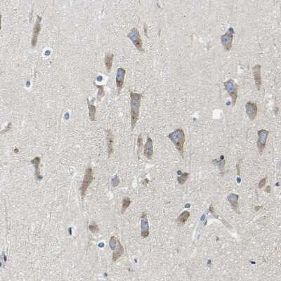 Immunohistochemistry-Paraffin: LIAS Antibody [NBP1-82845]
