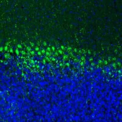 Immunohistochemistry: LIAS Antibody [NBP1-82845]