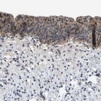 Immunohistochemistry-Paraffin: LIAS Antibody [NBP1-82846]