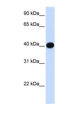 Western Blot: LIAS Antibody [NBP1-54319]