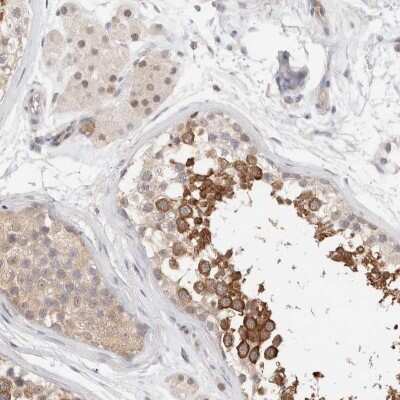 Immunohistochemistry-Paraffin: LIAT1 Antibody [NBP1-81295]