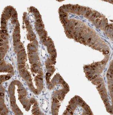 Immunohistochemistry-Paraffin: LIAT1 Antibody [NBP1-81295]