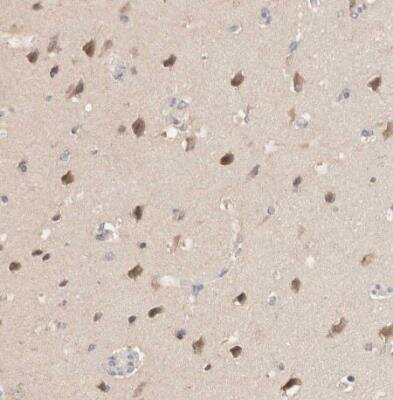 Immunohistochemistry-Paraffin: LIAT1 Antibody [NBP1-81295]