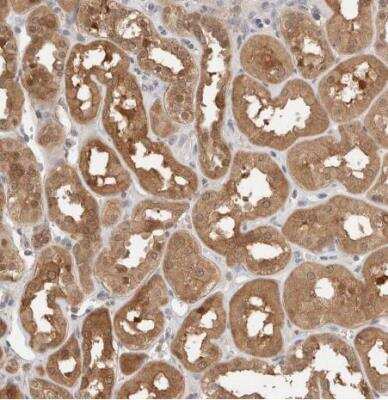 Immunohistochemistry-Paraffin: LIAT1 Antibody [NBP1-81295]
