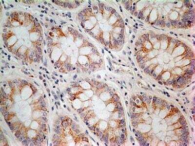Immunohistochemistry-Paraffin: LIF Antibody (39N7D10) - BSA Free [NBP2-27406]