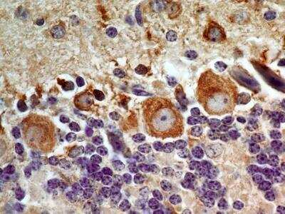 Immunohistochemistry-Paraffin: LIF Antibody (39N7D10) - BSA Free [NBP2-27406]