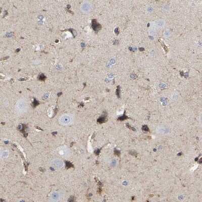 Immunohistochemistry-Paraffin: LIF Antibody [NBP1-85717]