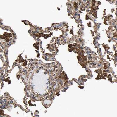 Immunohistochemistry-Paraffin: LIF Antibody [NBP1-85717]