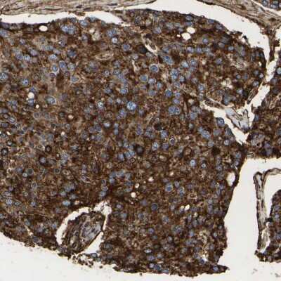 Immunohistochemistry-Paraffin: LIF Antibody [NBP1-85717]