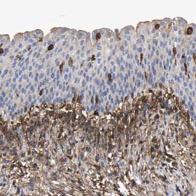 Immunohistochemistry-Paraffin: LIF Antibody [NBP1-85717]