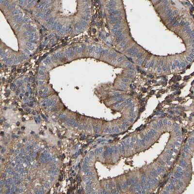 Immunohistochemistry-Paraffin: LIF Antibody [NBP1-85717]