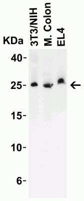 Western Blot: LIF AntibodyBSA Free [NBP1-76554]