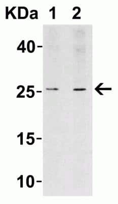 Western Blot: LIF AntibodyBSA Free [NBP1-76554]