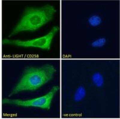 Immunocytochemistry/ Immunofluorescence: LIGHT/TNFSF14 Antibody [NBP1-51981]