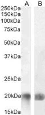 Western Blot: LIGHT/TNFSF14 Antibody [NBP1-51981]