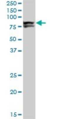 Western Blot: LIM Kinase 1 Antibody (1A8) [H00003984-M01]