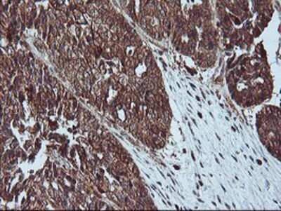 Immunohistochemistry-Paraffin: LIM Kinase 1 Antibody (OTI3H6) [NBP2-00748]