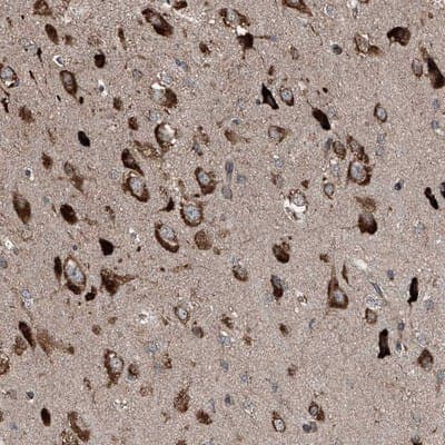 Immunohistochemistry-Paraffin: LIM Kinase 1 Antibody [NBP1-87721]