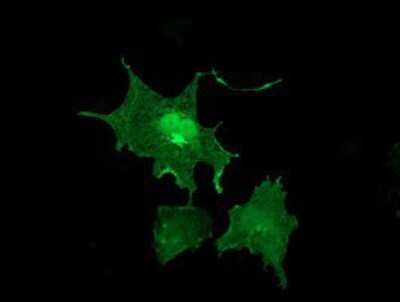 Immunocytochemistry/ Immunofluorescence: LIM Kinase 1 Antibody (OTI3H6) - Azide and BSA Free [NBP2-71141]