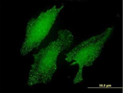 Immunocytochemistry/ Immunofluorescence: LIM domain only 3 Antibody (2H2) [H00055885-M03]